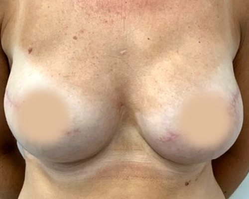 beforeafter13-80